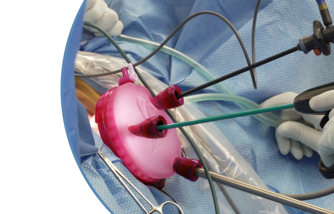 Chirurgie V-notes